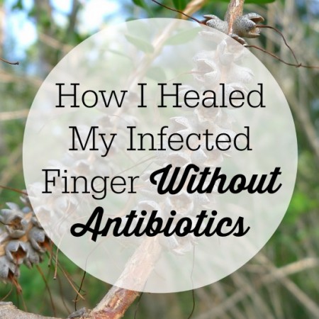 infectedfinger