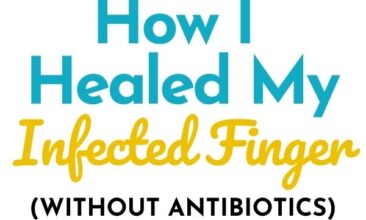 Pinterest pin with two images. The first image is of a woman putting a bandaid on her finger. The second image is of a bottle of essential oil sitting on a counter with herbs. Text overlay says, "How I healed my infected finger: all natural without antibiotics".