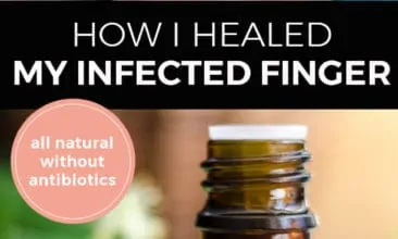 Pinterest pin with two images. The first image is of a woman putting a bandaid on her finger. The second image is of a bottle of essential oil sitting on a counter with herbs. Text overlay says, "How I healed my infected finger: all natural without antibiotics".