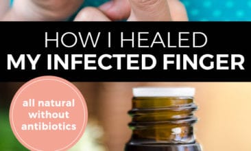 How I Healed My Infected Finger Without Antibiotics Red And Honey