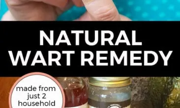 Pinterest pin with two images. The first image is a woman putting a bandaid on her finger. The second image is of a jar of apple cider vinegar, a jar of coconut oil, bandaids and cotton balls sitting on a kitchen counter. Text overlay says, "Natural Wart Remedy: made from just 2 household ingredients!".
