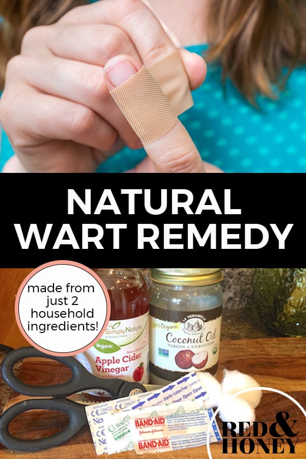 Pinterest pin with two images. The first image is a woman putting a bandaid on her finger. The second image is of a jar of apple cider vinegar, a jar of coconut oil, bandaids and cotton balls sitting on a kitchen counter. Text overlay says, "Natural Wart Remedy: made from just 2 household ingredients!".