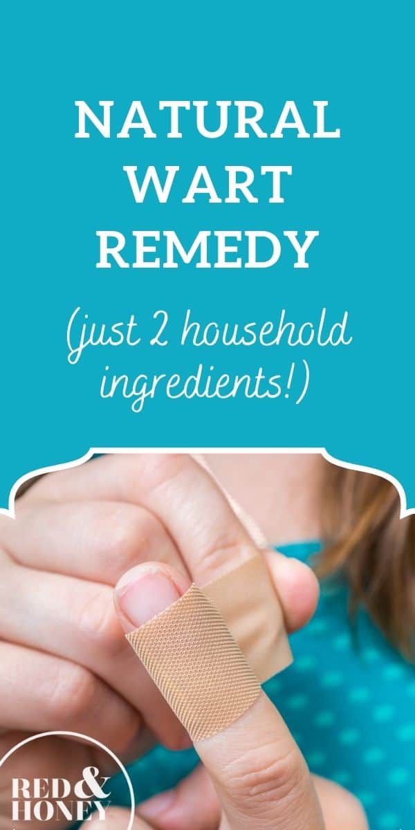 How to Use Apple Cider Vinegar for Warts (Effective Home Remedy)