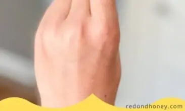 a pin image of a finger in the air with a wart bandaid on it, plus text overlay in yellow that reads Wart Remedy